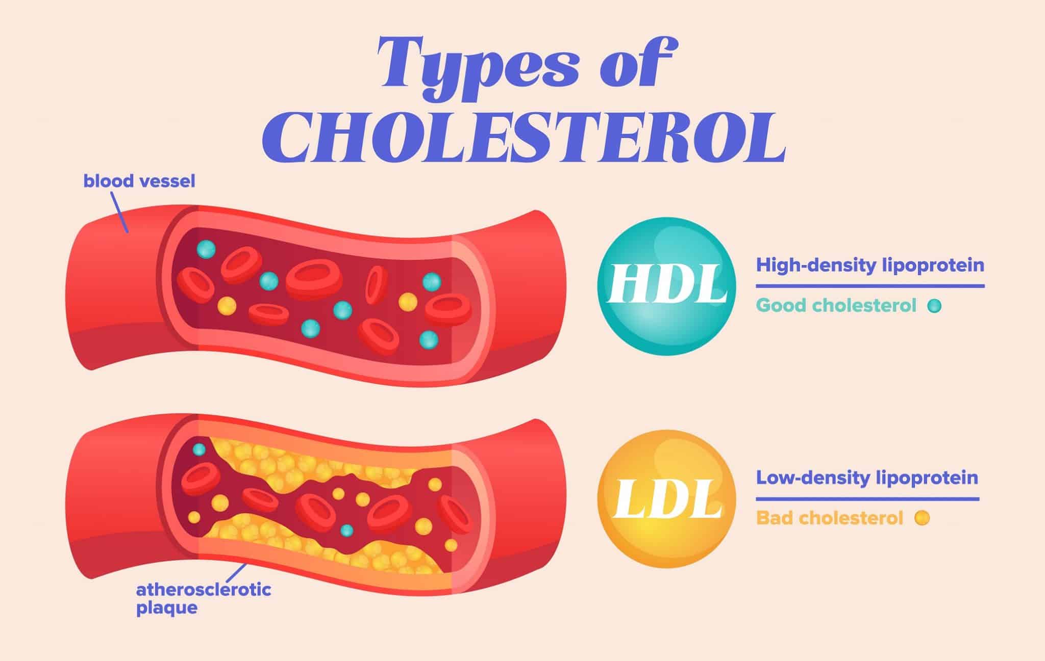 understanding-ldl-hdl-particles-for-optimal-brain-health-excelmale