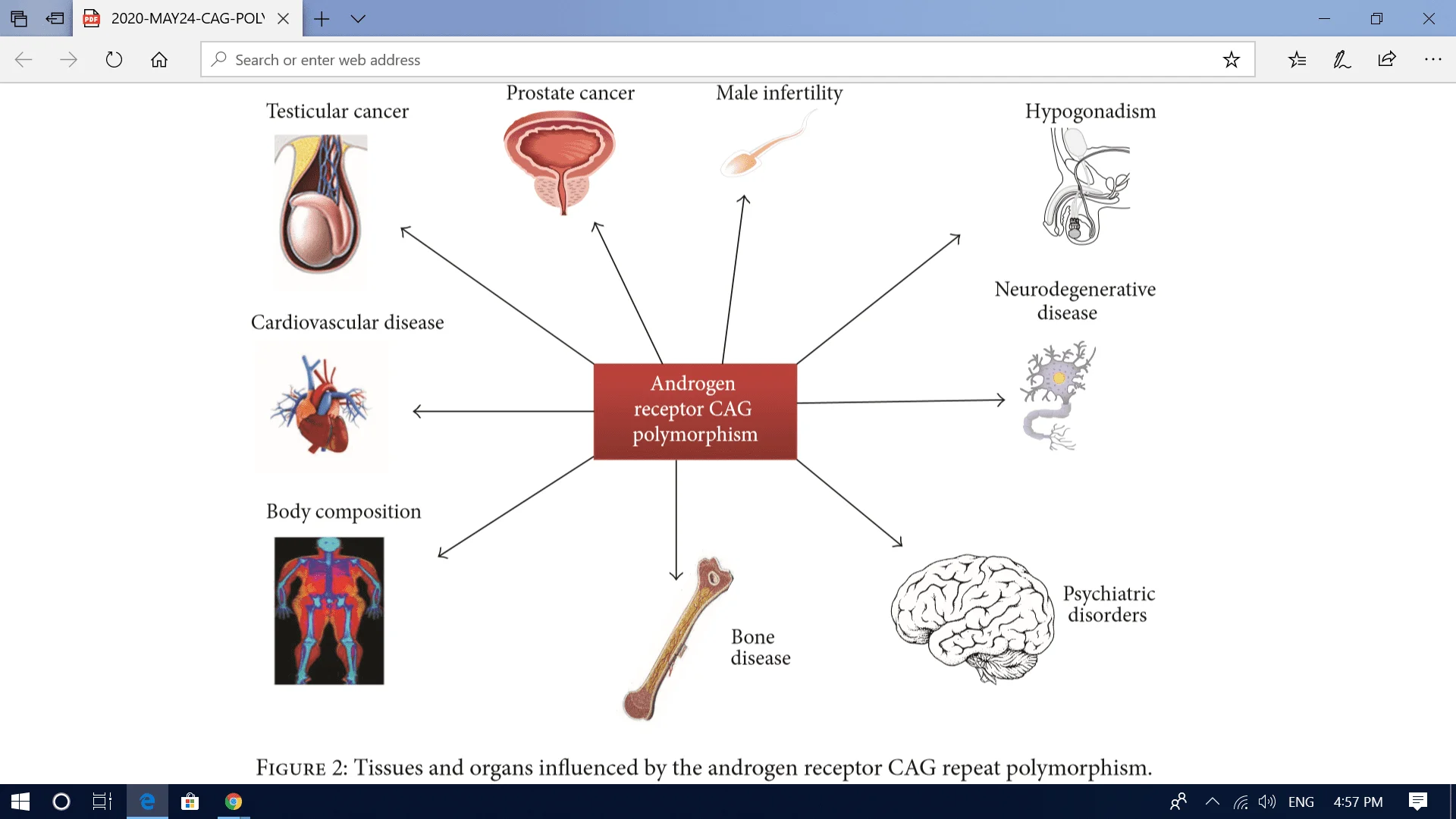 CAG repeat influenced organs.webp