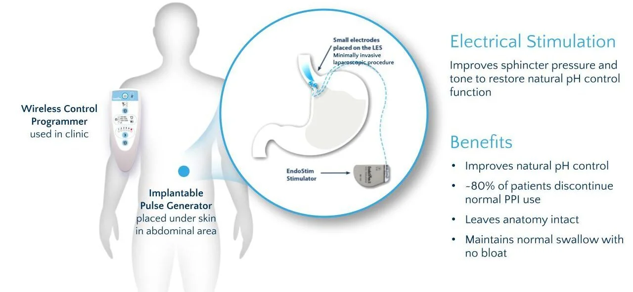 endostim.webp