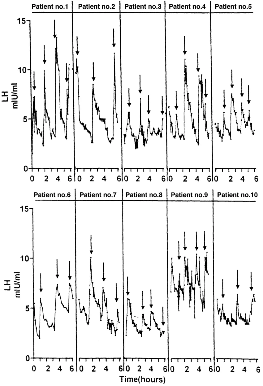 Luteinizing-hormone-LH-pulsatility-in-10-men-with-proven-fertility-The-LH-profile-was.webp