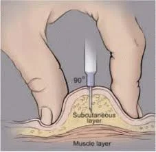 subcutaneous testosterone.webp