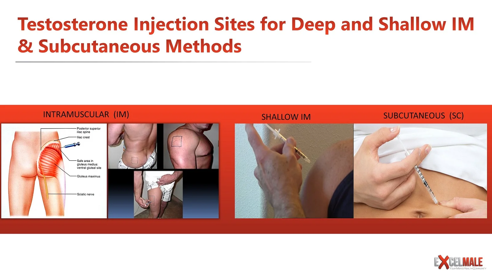 subcutaneous versus intramuscular IM testosterone injections.webp