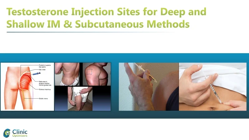 testosterone injection sites.webp