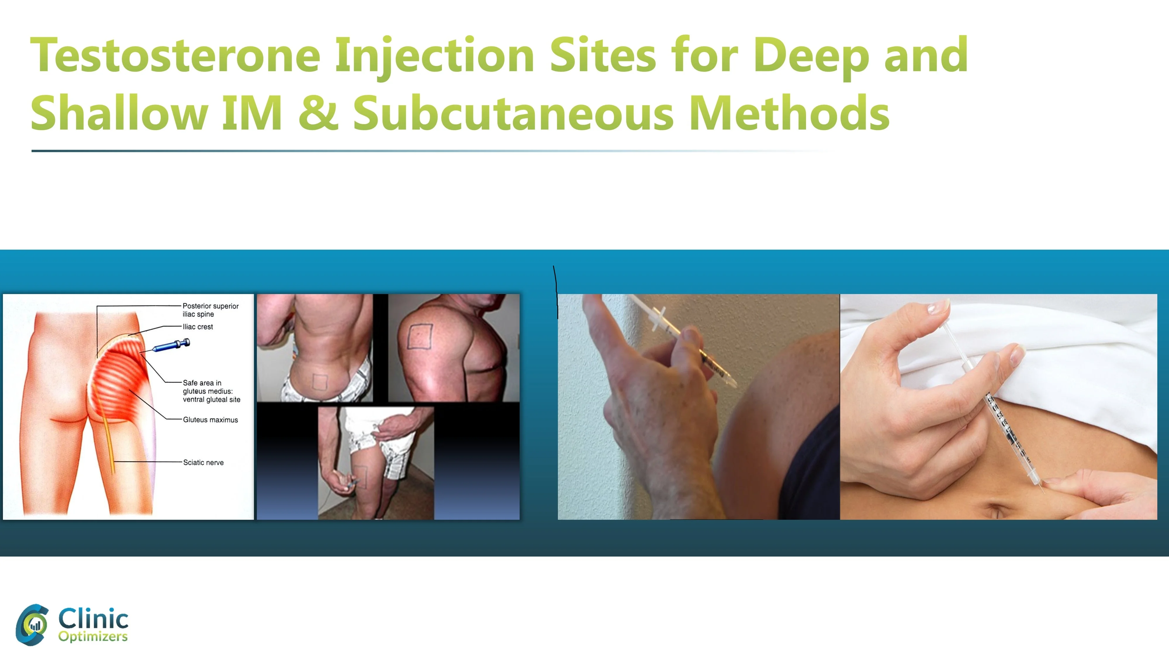 testosterone injection sites.webp