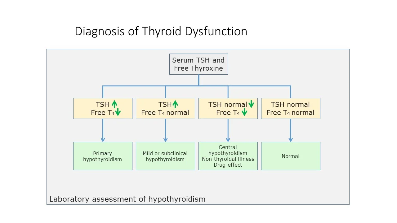 thyroid diagnosis.webp