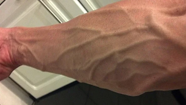 veins.jpg