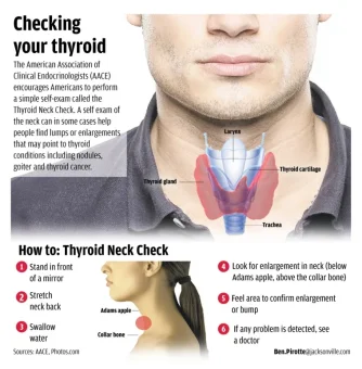 thyroid (1).webp