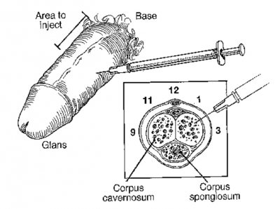 TriMix Injection Area.jpg