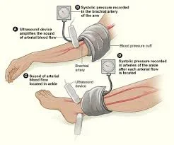 arterialblood.webp