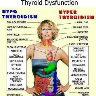 ThyroidDysfunction.webp