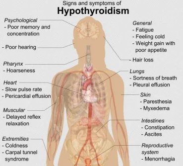 Signs_and_symptoms_of_hypothyroidism.png.webp