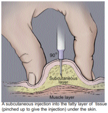 220px-Subcutaneous_injection.png