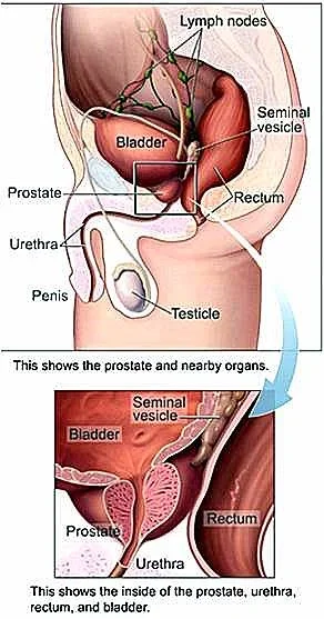 prostate.webp