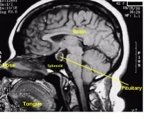 pituitarylabelled2.webp