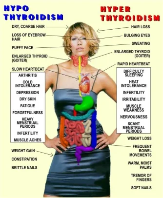 hypo hyper thyrodism.webp