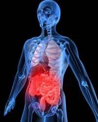 ulcerative-colitis.webp