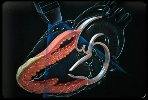 heart_disease_s13_echocardiography.webp