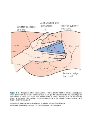 venrto glute 1.webp