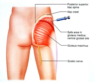 ventro glute 3.webp