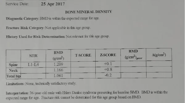 Bone Density scan - April 2017.webp