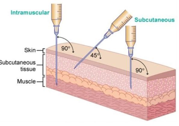 Subcutaneous Testosterone Injections Are Effective for TRT - ExcelMale