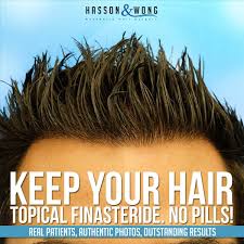 finasteride and minoxidil side effects reddit